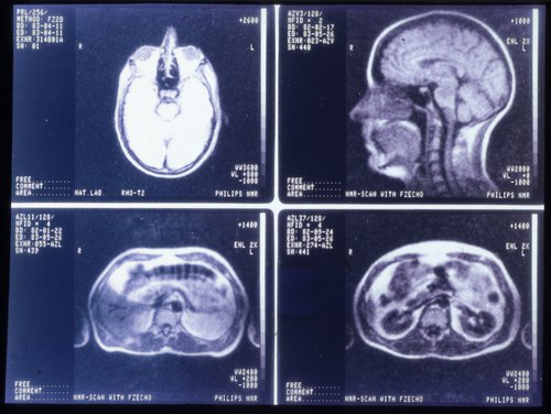 Fig3 MRI