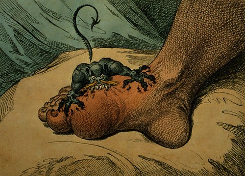 James Gillray, The gout, 1799